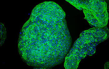 Fibroblasts and macrophages grown using synthetic gel