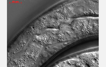 Roundworm intestine infected with spores of newly discovered species of microsporidia cytoplasm