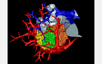 A detailed 3-D image of a mammal lung