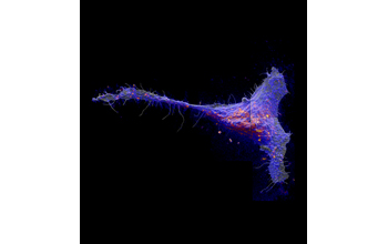 A class of molecules called sphingolipids congregate in large patches in the cell membrane