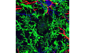 Glia cells in a mouse brain