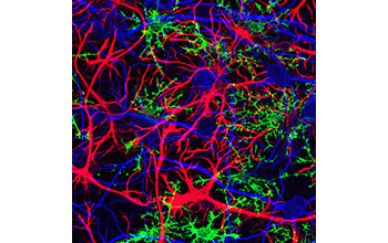 Star-shaped glia cells called astrocytes (red), young oligodendrocytes (green) and neurons (blue cells)