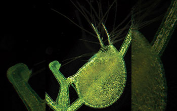 A light micrograph of the bladder of a carnivorous bladderwort plant (<em>Utricularia gibba</em>)