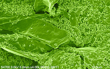 Clumps of bacteria and iron plaque forming on the roots of a rice plant