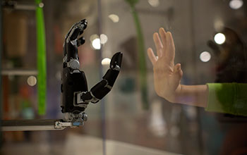 Prosthetic arm