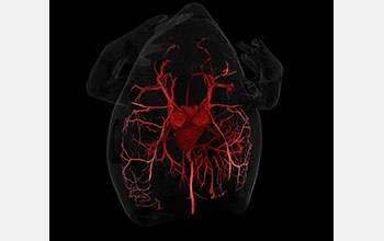 CT scan of circulatory system of Mexican narrow-mouthed toad