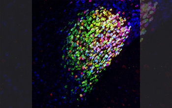 Neuron cells in the central amygdala of a mouse brain