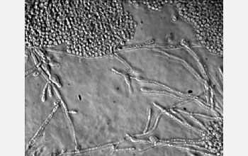 The pathogenic fungus <em>Candida albicans</em>