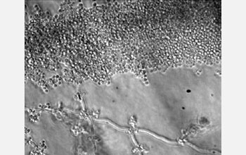 The pathogenic fungus <em>Candida albicans</em>