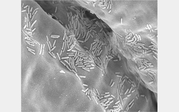 Photomicrograph of microbes in the gut of a locust.