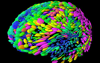 Template brain used in the study of anatomical brain differences related to aging and disease