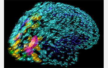 Template brain used in studies of anatomical brain differences related to aging and disease