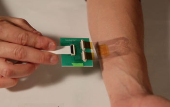 hand witha smart bandage