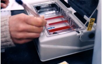 A BIOTECH Project student participant conducts DNA fingerprinting