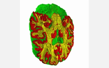 Interfaces between white matter, gray matter and other matter for a human brain dataset