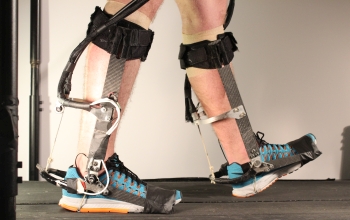 feet walking on treadmill with prosthetics