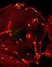 <em>Listeria</em> Monocytogenes bacteria