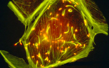 Bacterium <em>Listeria monocytogenes</em> travels in a cell using comet-like tails