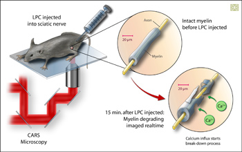 New imaging techniques could promote early detection of conditions such as multiple sclerosis