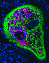 The antibody found in the gut of rainbow trout, known as IgT