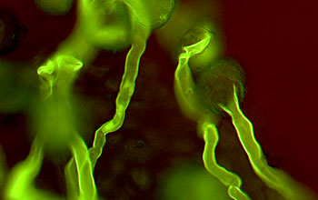 Pollen tubes emerging from pollen grains on stylar surface of <em>Austrobaileya scandens</em>