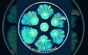 Colonies of bacterium send branches of cells in all directions, but patterns of both colonies become lopsided, leaving a space between the two if forced to share limited nutrients