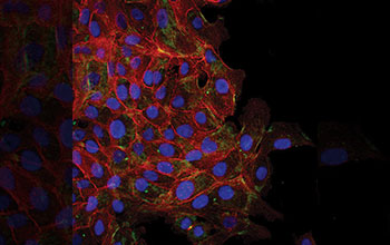 Normal epithelial cells store a mechanical memory of their past matrix stiffness