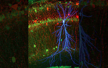 Stained pyramidal cell in area CA1 of mouse hippocampus