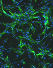 Picture depict how cells within the heart valve can be regulated