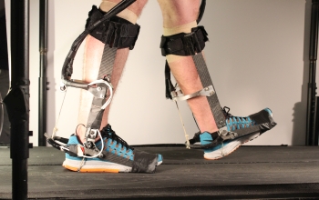 legs walking with prosthetic limbs on treadmill