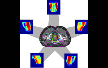 An intensity-modulated radiation therapy (IMRT) planning algorithm