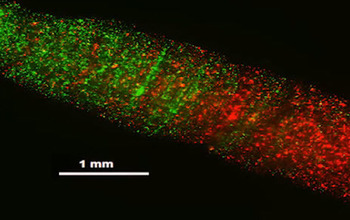 microscopic view of nerve